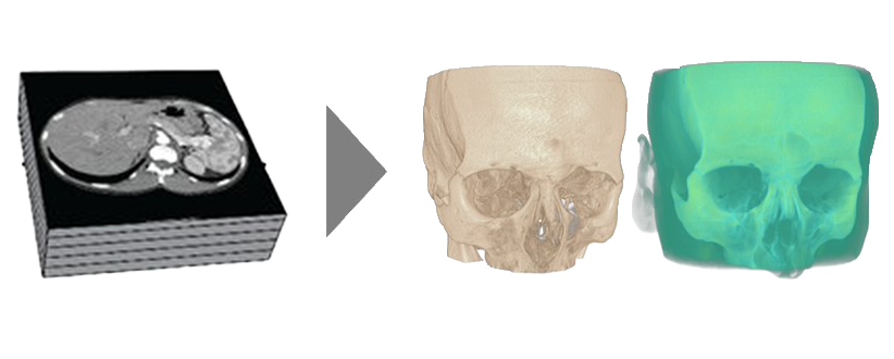 Pipeline from stacked DICOM slices to opaque and translucent 3D skull renders.