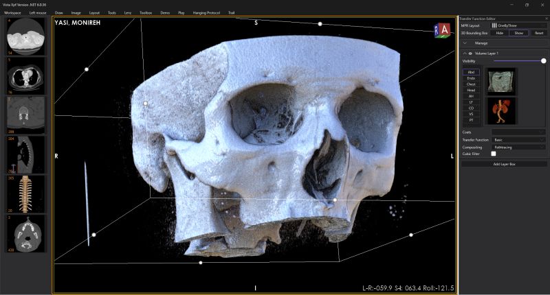 Cinematic GPU volume path tracer in the ZEUS workstation: a CT skull rendered with path-tracing compositing, transfer-function controls, and 3D orientation overlay.